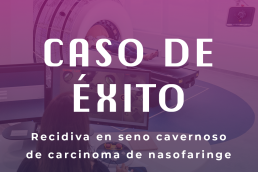 Recidiva en seno cavernoso de carcinoma de nasofaringe
