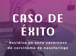 Recidiva en seno cavernoso de carcinoma de nasofaringe