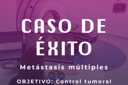 Radiocirugía en metástasis cerebrales