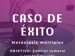 Radiocirugía en metástasis cerebrales