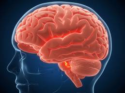 meningioma perióptico